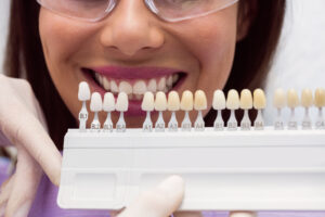dental veneers for teeth